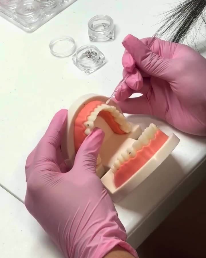 Gloved hands working on a dental model beside small jars of tooth gems